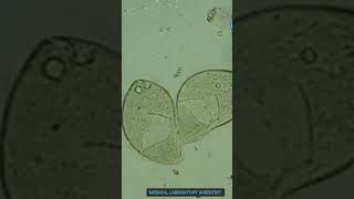 Balantidium Coli Microscopic Examination trending shortsviral shortvideo shorts [upl. by Aramanta717]