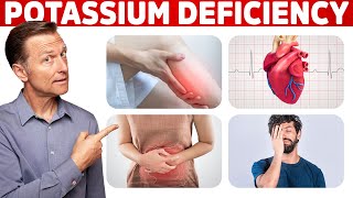 Low Potassium Signs Symptoms Causes and Treatment [upl. by Enoed]