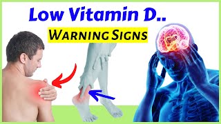 Signs of Vitamin D deficiency 12 Symptoms You Need To Know [upl. by Vilberg492]