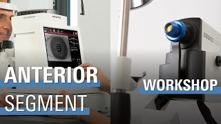 WORKSHOP Anterior Segment Imaging  ANTERION amp SPECTRALIS Anterior Segment Module ASM [upl. by Imuy]