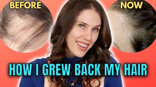 10 Best amp Worst Hair Growth Treatments That I’ve Tried At Home [upl. by Ecinuahs]