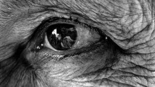 The Ageing Eye  Professor William Ayliffe [upl. by Ilzel21]