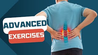 Spondylolisthesis ADVANCED EXERCISES for active people [upl. by Bran]