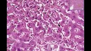 Histopathology Lung and liverCongestion and hemorrhage [upl. by Nnyleahs880]