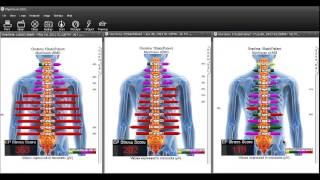 What is The EP Stress Score [upl. by Tal330]