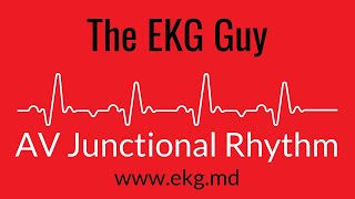 AV Junctional Rhythm EKG l The EKG Guy  wwwekgmd [upl. by Uticas]