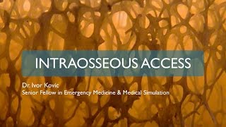 Intraosseous access [upl. by Alicirp370]