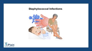 Staphylococcal Infections [upl. by Snapp91]