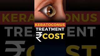 Keratoconus Surgery Cost C3R [upl. by Rialcnis866]