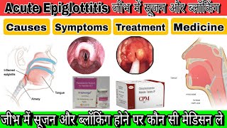 Epiglottitisगले में सूजन और गले का बंद होनाFull treatment in Hindithroatinfectionpainswelling [upl. by Ysied]