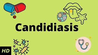 CANDIDIASIS Causes Signs and Symptoms Diagnosis and Treatment [upl. by Naeloj]