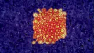 Immunotherapy Boosting the immune system to fight cancer [upl. by Jemma]