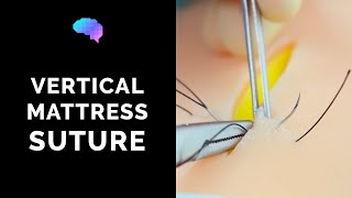 Vertical Mattress Suture  OSCE Guide  UKMLA  CPSA [upl. by Poll]