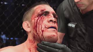 Nick Diaz as bloody as it can get UFC 5 [upl. by Freddi]