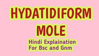 Hydatidiform Mole  We For You OBG MOHIT SIR [upl. by Isyak195]