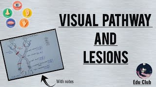 Visual field changes in glaucoma [upl. by Llerdnek618]