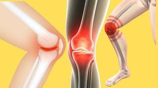 Your Knee Pain Holding You Back Discover CoralBased Solutions orthopedics [upl. by Tirzah]