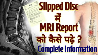 How To Read MRI Report Of SLIPPED DISC  L4L5 L5S1 Sipped Disc DIAGNOSIS  In Hindi [upl. by Aowda]