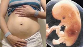 Panza De 8 Semanas De Embarazo y Desarrollo del feto embrion  Pregnancy Belly Fetal Development [upl. by Cleveland]