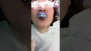 alginate impression with amazing records viral alginate trending ytshorts youtubeshorts video [upl. by Haduhey437]