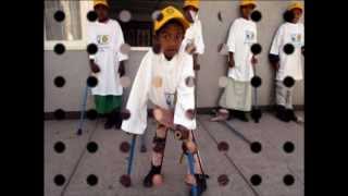 Polio Disease [upl. by Desmond]