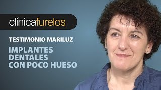 Mari Luz Implantes dentales con poco hueso [upl. by Ezra]