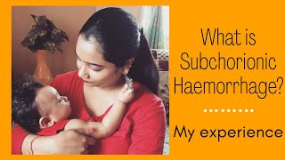 What is Subchorionic haemorrhage  Subchorionic Haematoma My experience  In English and Hindi [upl. by Nahama]