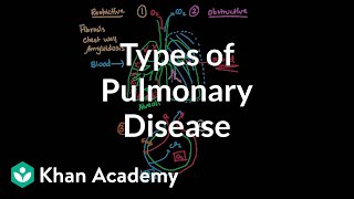 Types of pulmonary diseases  Respiratory system diseases  NCLEXRN  Khan Academy [upl. by Kcirddes]