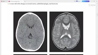 NEURORADIOLOGY OXFORD CASES [upl. by Basso212]