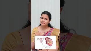 How to test Infertility Problems  Mythri Sri Fertility Centre telugushorts infertility shorts [upl. by Harbert]