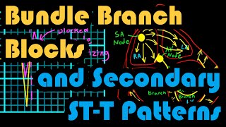 Bundle Branch Blocks and Secondary STT Patterns How to Read an EKG Curriculum [upl. by Anaeda775]