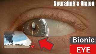 Neuralinks Vision The Future of Bionic EyesBionic Eyes Experiment BionicEye [upl. by Merril665]