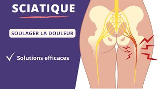 Sciatique  cause symptômes et traitement  Comment soulager la douleur du nerf sciatique  ⚡️ [upl. by Nirihs]