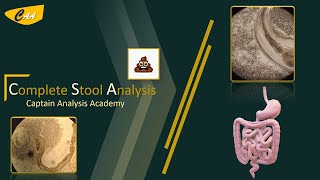 Complete Stool Fecal Analysis تحليل البراز عملى [upl. by Ylrebmi129]