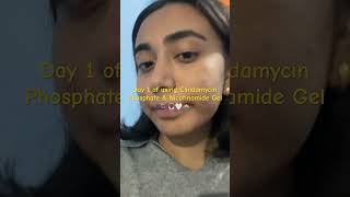 Using Clindamycin Phosphate amp Nicotinamide Gel girls skincare acne [upl. by Aluino]