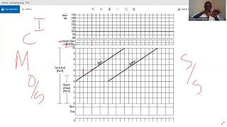 partograph OSCE [upl. by Orihakat]