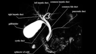 MRCP planning and protocol [upl. by Mandych840]