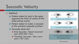 Saccadic Velocity [upl. by Adnyleb729]