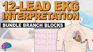 Bundle Branch Blocks MADE EASY  12 Lead EKG [upl. by Amihsat]