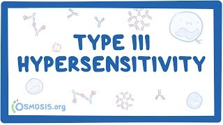 Type III hypersensitivity immune complex mediated  causes symptoms amp pathology [upl. by Trumaine]