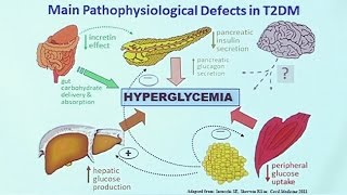 Making Sense of Diabetic Medications [upl. by Litnahs]