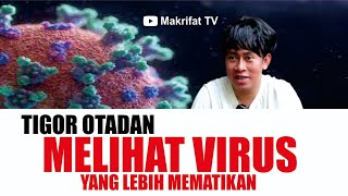 TIGOR OTADAN MELIHAT VIRUS YANG LEBIH MEMATIKAN [upl. by Jacquelyn]