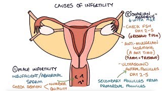 Understanding Infertility Causes and Investigations [upl. by Gnuy]