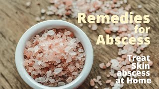 Home Remedies for Abscess  3 Safe Ways to Treat Skin Abscess at home [upl. by Eaves]