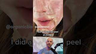 Reacting to this chemical peel thats done at home 🫣 credit organicbeautylover on TT [upl. by Sikorski]