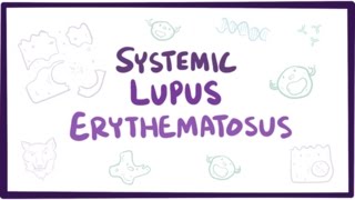 Systemic lupus erythematosus SLE  causes symptoms diagnosis amp pathology [upl. by Cilla]