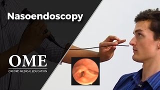 Nasoendoscopy Nose Examination  ENT [upl. by Eaton724]