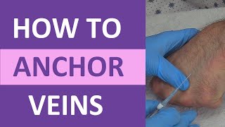 How to Anchor Veins  Venipuncture IV Therapy Blood Draw Phlebotomy Rolling Veins [upl. by Norret]