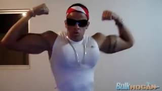 Synthol Abuse definitely not a bodybuilder RODRIGO FERRAZ [upl. by Ellatnahc]