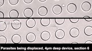 DIY tests to detect malaria sleeping sickness [upl. by Rosenstein]